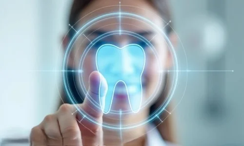 Extractions Extractions